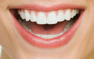 TEETH WHITENING